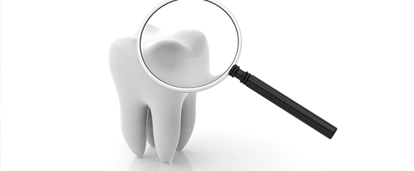 予防歯科とは イメージ画像