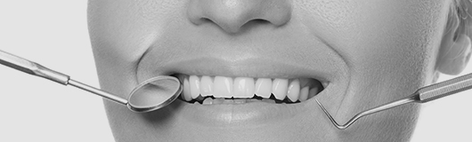 歯周病治療 イメージ画像
