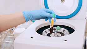 CGF の作製 (遠心分離)