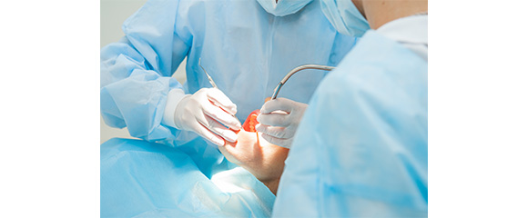 手術部への応用