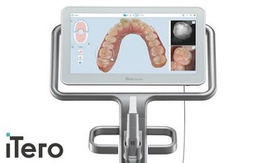 ３Ｄスキャナー「iTero」を導入しています