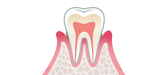 歯肉炎 画像