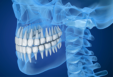 外科的歯内療法 イメージ画像